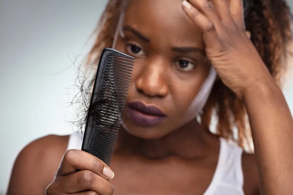 Why Am I Losing My Hair? | Fedhealth Medical Aid